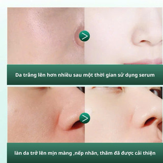 Tinh Chất Dương  Ẩm và Làm Sáng Da Retinol Centella Cao Cấp 40ml