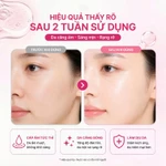 Combo 4 Hộp Mặt Nạ Thạch IMU Deep Collagen Jelly Pack Cấp Ẩm, Phục Hồi, Dưỡng Sáng, Ngừa Lão Hóa Mờ Nhăn 34g (16 Miếng) — ảnh 3