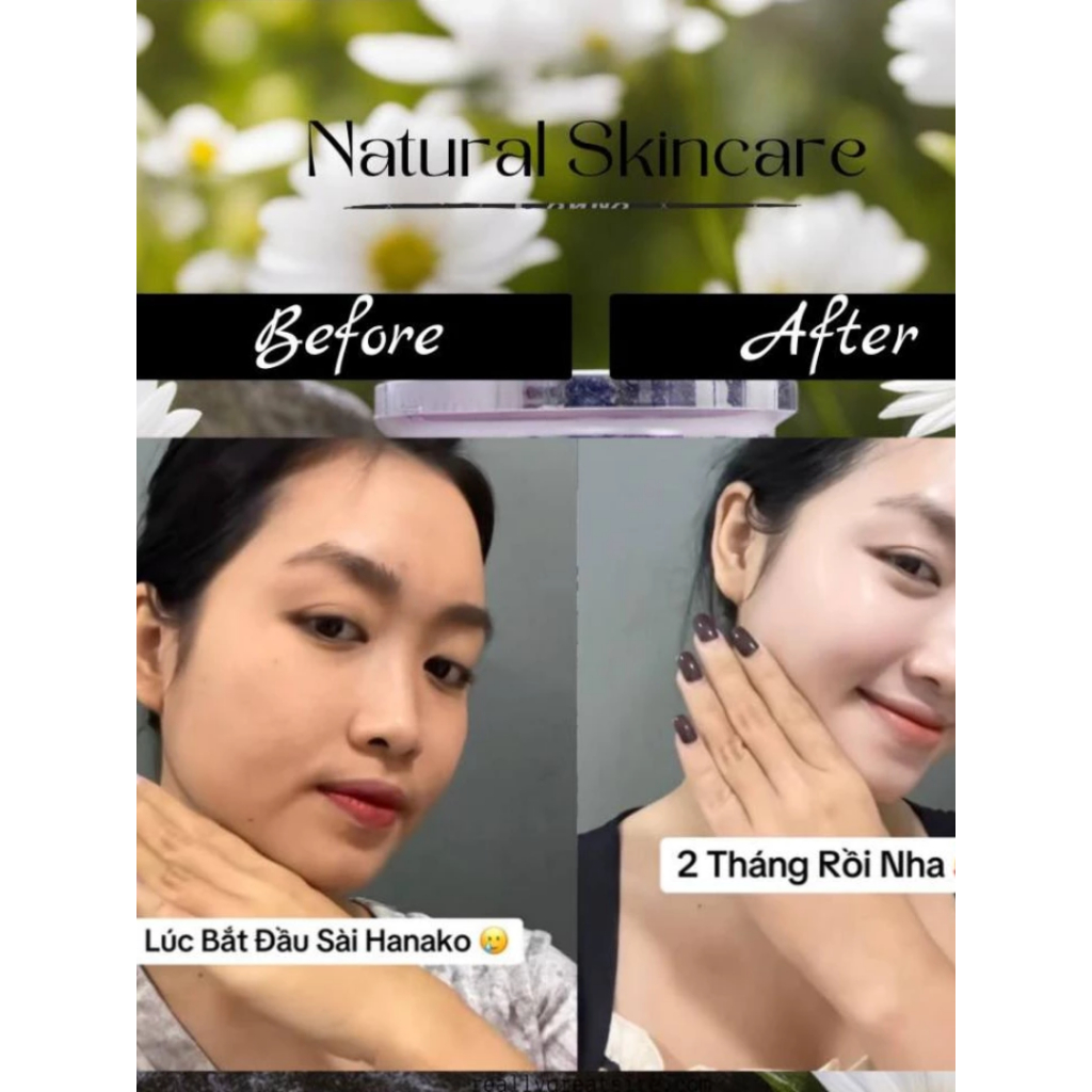 Kem Face Dưỡng Sáng Da Nhật Bản Hanako x3 Mờ Thâm Mụn Cấp Ẩm Chống Nắng