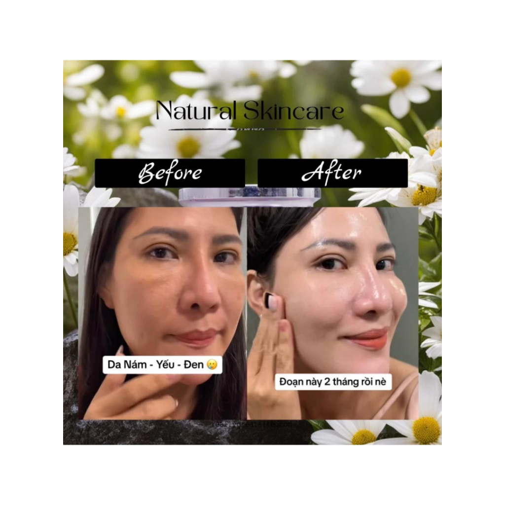 Kem Face Dưỡng Sáng Da Nhật Bản Hanako x3 Mờ Thâm Mụn Cấp Ẩm Chống Nắng