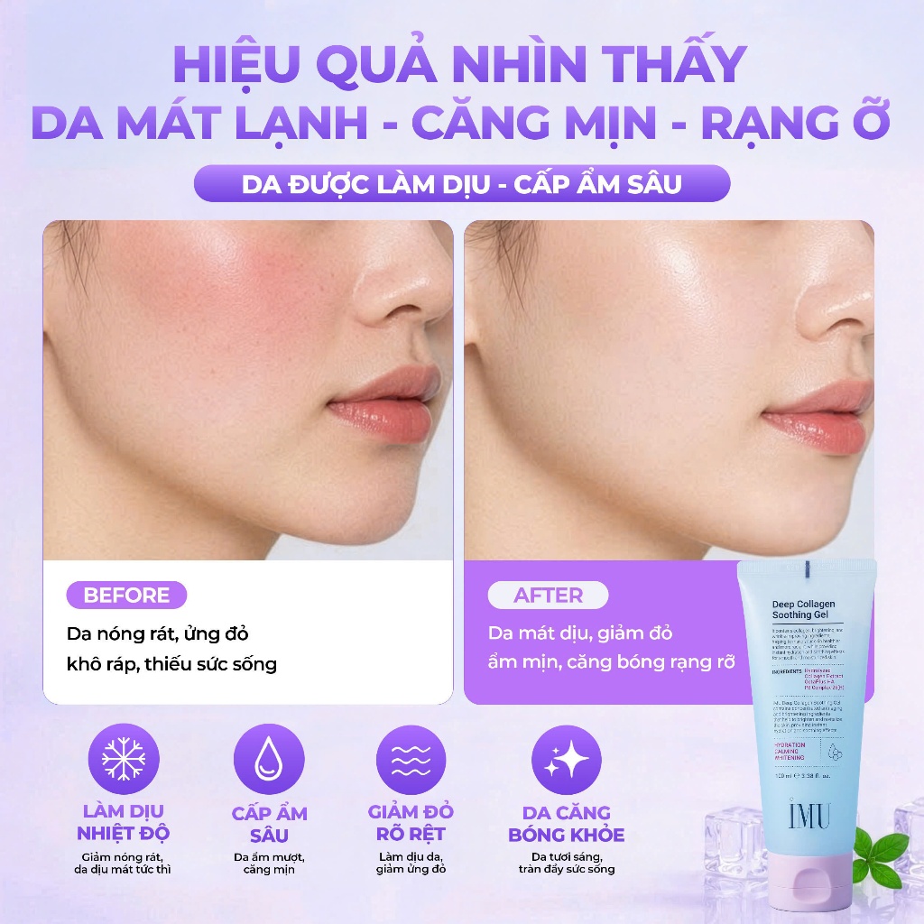Gel Dưỡng Ẩm IMU Deep Collagen Soothing Gel Phục Hồi Da Làm Dịu Ngừa Mụn 100ml