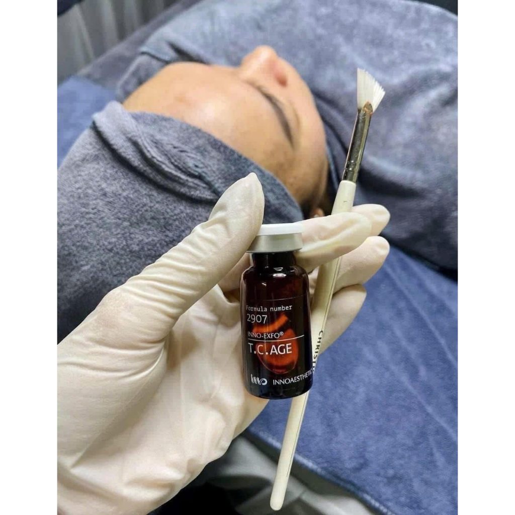 Tinh chất peel da INNOAESTHETICS T.C.AGE cho da sẹ.o, trẻ hóa da 5ml 1 lọ ( Tặng kèm cọ quét hoặc k.i.m)
