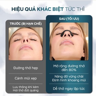 MIẾNG DÁN HỖ TRỢ ĐƯỜNG THỞ KIRA BrEASY – THOẢI MÁI HÍT THỞ MỖI NGÀY