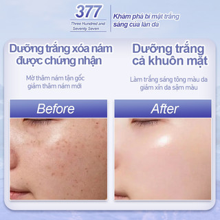377 Kem làm trắng xóa nám Niacinamide 50ml，Làm trắng、làm mờ tàn nhang đốm nâu, chống lão hóa、Giúp Mờ Nám, Cấp Ẩm