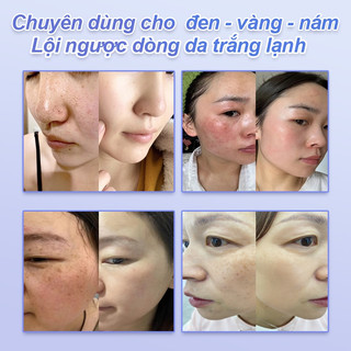 377 Kem làm trắng xóa nám Niacinamide 50ml，Làm trắng、làm mờ tàn nhang đốm nâu, chống lão hóa、Giúp Mờ Nám, Cấp Ẩm