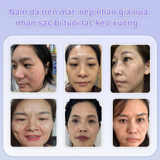 377 Kem làm trắng xóa nám Niacinamide 50ml，Làm trắng、làm mờ tàn nhang đốm nâu, chống lão hóa、Giúp Mờ Nám, Cấp Ẩm