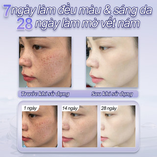 377 Kem làm trắng xóa nám Niacinamide 50ml，Làm trắng、làm mờ tàn nhang đốm nâu, chống lão hóa、Giúp Mờ Nám, Cấp Ẩm