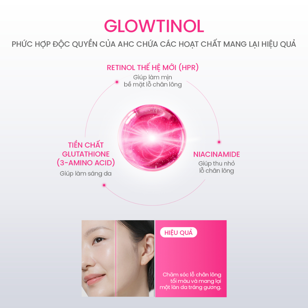 Tinh Chất Serum Vi Kim Thu Nhỏ Lỗ Chân Lông AHC Cho Da Láng Mịn Căng Bóng (Retinol + Glutathione + Niacinamide) 30ml