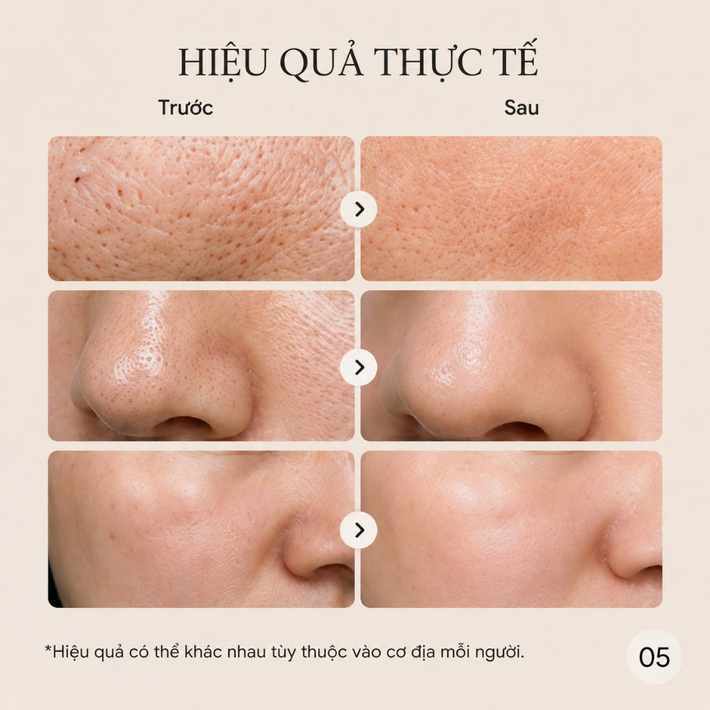 GZONNIO Green Tea Spicule Mask 120g | Làm Sạch Sâu - Tái Tạo Da - Hỗ Trợ Thu Nhỏ Lỗ Chân Lông