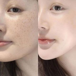 Combo Bạch Ngọc Giảm Nám Ruee CB0183 -  Dưỡng trắng, mờ nám, căng bóng da