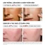 Serum Detox Giảm Mụn Thâm, Serum Mụn Da Sần
