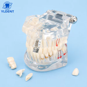 YLDENT Mẫu hàm tư vấn bệnh lý - Mẫu hàm tư vấn 8in1 (Có Xuất VAT)