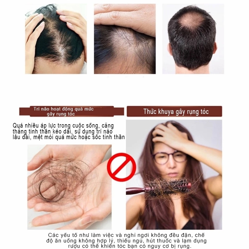 [MỚI] Dầu Gội nhân sâm Thảo Dược PINK FUTURE thúc đẩy mọc tóc mới và ngăn ngừa rụng tóc 300ml