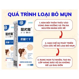 Kem Mụn Cóc Mụn Thịt Nhật Bản Hỗ Trợ Chăm Sóc Da Thừa Mụn Cóc Dạng Sợi, Giúp Da Mịn Màng Hơn 20g