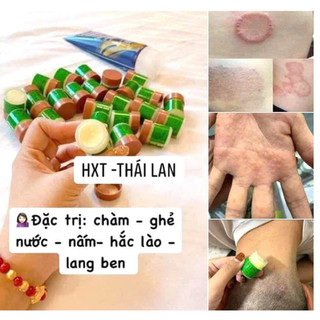 [CHÍNH HÃNG] Kem 29A Thái Lan Giúp Làm Hạn Chế Nấm Da, Hắc Lào, Lang Ben, Ghẻ Ngứa – CÔ THƯ MARKET
