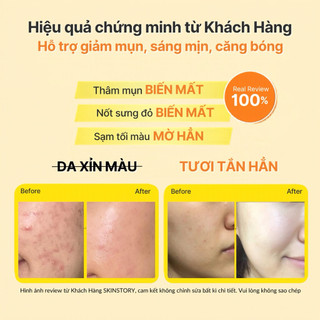 Mặt nạ nghệ thảo mộc Flower, mặt nạ nghệ thiên nhiên mờ thâm, hỗ trợ sáng da, giúp da mịn màng, 120g Skinstory Việt Nam