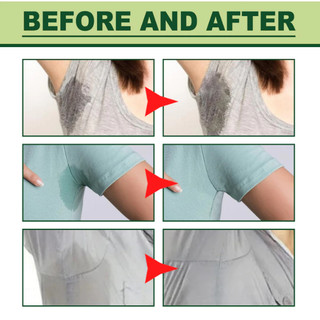Xịt khử mùi hôi nách giảm mồ hôi nách cho mùa hè nóng bức 30ml