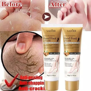 Kem Dưỡng Gót Chân Giảm Nứt Gót Chân Chai Sần Dưỡng Da Chân Và Tay Mềm Mịn SADOER Bơ Hạt Mỡ 60G