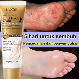 Kem Dưỡng Gót Chân Giảm Nứt Gót Chân Chai Sần Dưỡng Da Chân Và Tay Mềm Mịn SADOER Bơ Hạt Mỡ 60G
