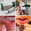 Kem Trinolone Nhiệt Miệng Oral Paste - Nida - 5g - SHOP DẦU DOKRAK