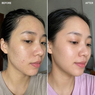 Combo Trẻ Hóa Retinol & Serum Chuskin CB0376 – Bộ Đôi Hỗ Trợ Mờ Nếp Nhăn, Dưỡng Sáng Đều Màu, Phục Hồi Da Chuyên Sâu