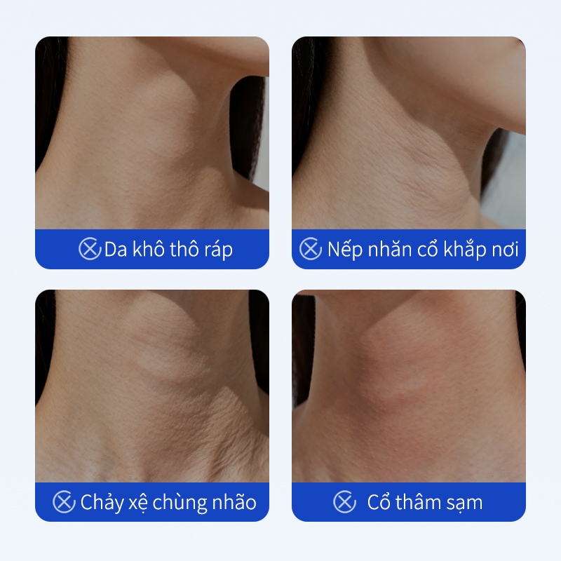 Mặt Nạ Cổ Peptide Collagen 20ml * 10 miếng, Giảm Nếp Nhăn Cổ, Nâng Cơ Săn Chắc, Dưỡng Ẩm Chống Lão Hóa