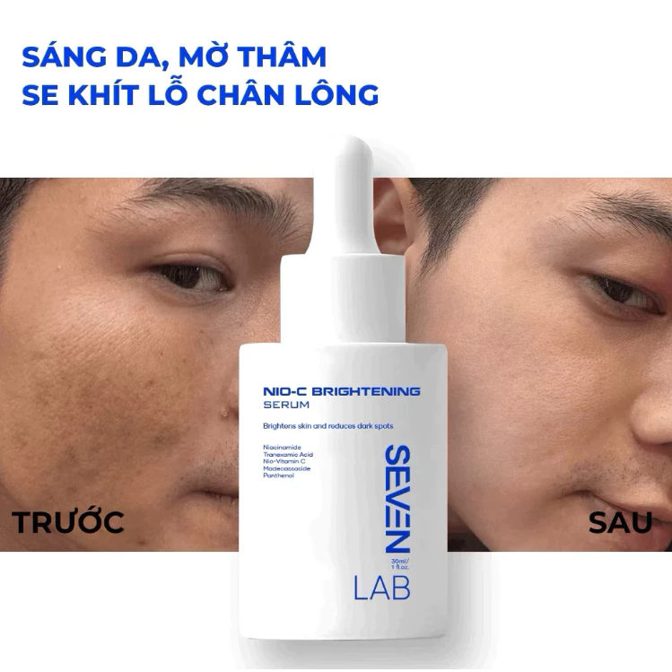 Serum Dưỡng Trắng Da SEVENLAB Dành Cho Nam Giới Giúp Mờ Thâm Bảo Vệ Da Mụn Vượt Trội 30ml