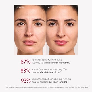 Dưỡng chất Retinol 1% M.Asam RETINOL INTENSE 1% Retinol Treatment 30ml