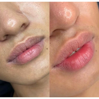 Collagen Lip Mask – Dưỡng Môi Chuyên Sâu- Nguyễn Quyên store