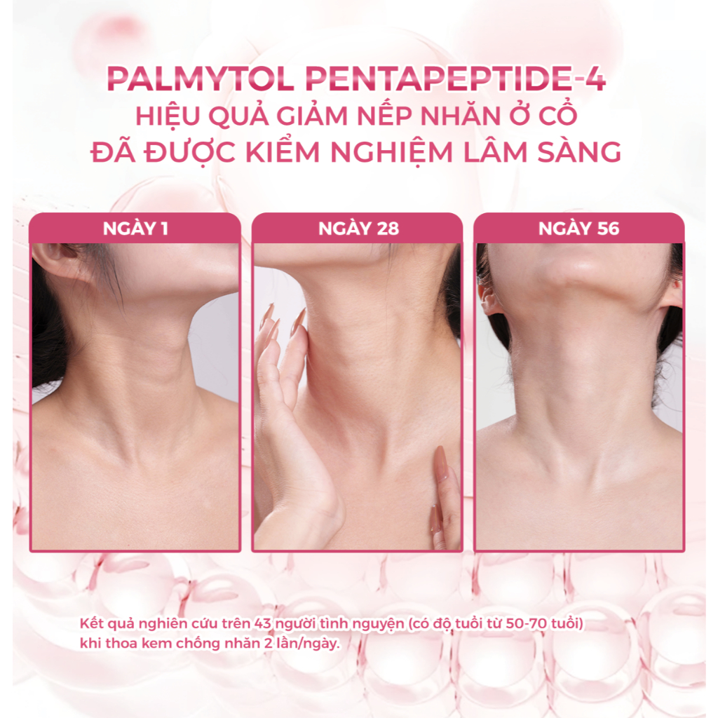 Kem Dưỡng Da Cổ Anta Aura Giúp Giảm Nếp Nhăn, Dưỡng Ẩm, Làm Sáng Da, Đã Được Nghiên Cứu lâm Sàng 50g