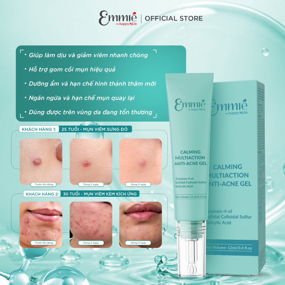 NEW 01 Tuýp Gel Làm dịu da Cải thiện mụn đa tác động CALMING MULTIACTION ANTI-ACNE 12ml Emmie by Happyskin