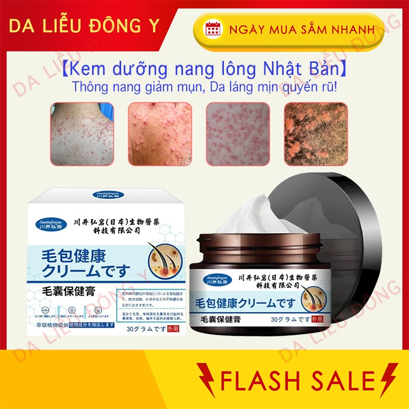 [Chính Hãng] Kem Bôi Viêm Nang Tóc, Gàu Ngứa Da Đầu SAKAIDO, An Toàn, Hiệu Quả, Kháng Khuẩn, Loại Bỏ Vảy Sừng 30G