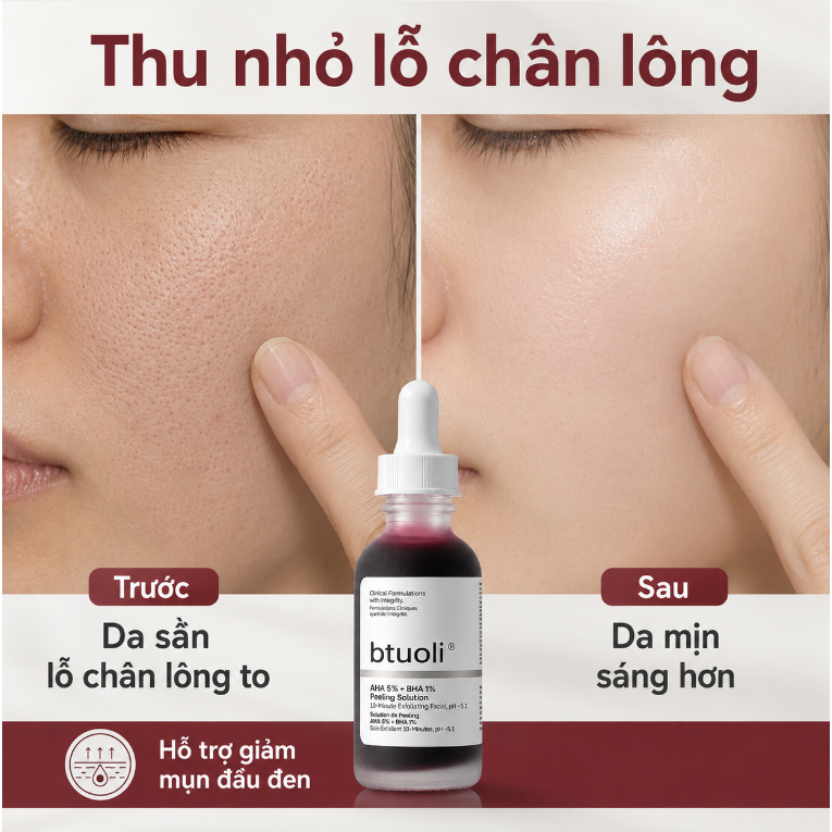 Serum AHA BHA 32ml Chuyên Trị Lỗ Chân Lông To & Mụn Đầu Đen Loại Bỏ Tế Bào Chết Se Khít Lỗ Chân Lông Cho Da Dầu Mụn