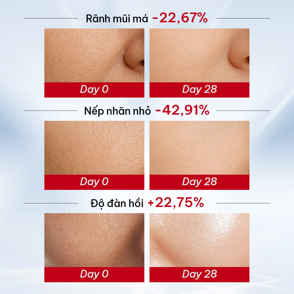 KANS Combo 5 Món Dưỡng Da Chống Lão Hóa Sữa Rửa Mặt - Toner - Lotion - Serum - Kem Dưỡng giúp Cấp Ẩm, Làm Mờ Nếp Nhăn