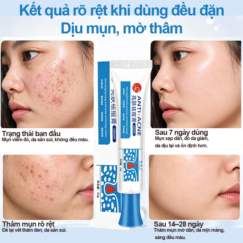 Kem chấm mụn 2 trong 1 giảm sưng đỏ thâm mụn, kháng khuẩn, làm sạch da cho mụn tuổi dậy thì