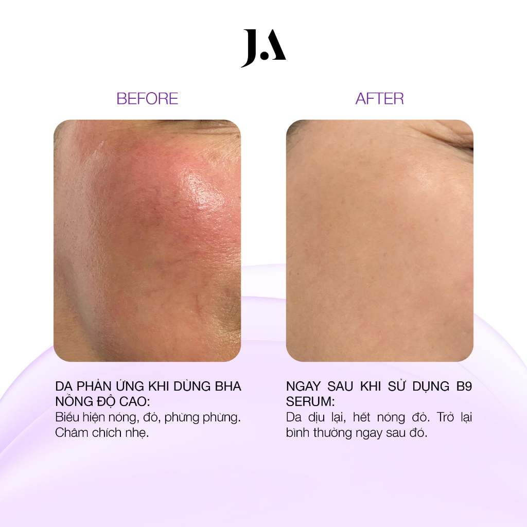 [Hàng công ty] Serum B9 Juliette Armand -Tinh chất phục hồi Folic Acid