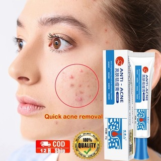 Kem chấm mụn cấp tốc loại bỏ các loại mụn, mụn đầu đen,mụn ở tuổi dậy thì,loại bỏ mụn bọc cho da dầu