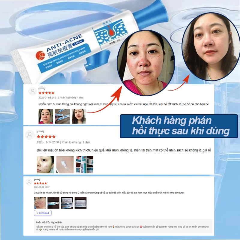 Kem chấm mụn 2 trong 1 giảm sưng đỏ thâm mụn, kháng khuẩn, làm sạch da cho mụn tuổi dậy thì