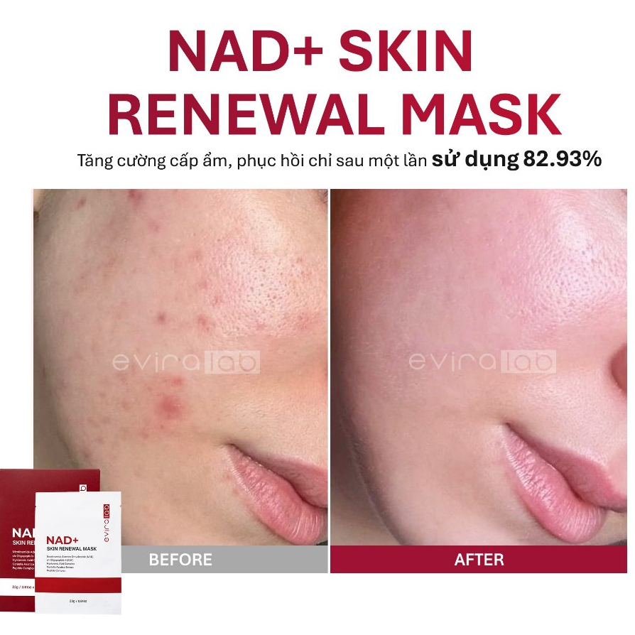 [GIFT] Mặt Nạ Tái Tạo Năng Lượng Tế Bào Eviralab NAD+ Skin Renewal Mask Pretty Skin 1-5 Miếng