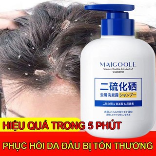 dầu gội sạch gàu loại bỏ mạt giảm ngứa làm sạch sâu da đầu Làm mới kiểm soát dầu 300ML
