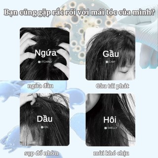 dầu gội sạch gàu loại bỏ mạt giảm ngứa làm sạch sâu da đầu Làm mới kiểm soát dầu 300ML