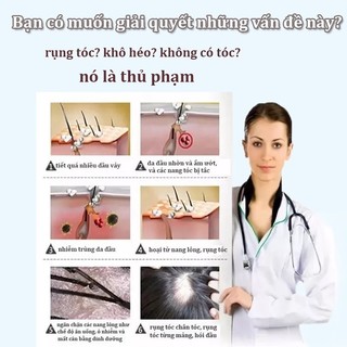 dầu gội sạch gàu loại bỏ mạt giảm ngứa làm sạch sâu da đầu Làm mới kiểm soát dầu 300ML