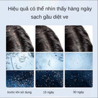 dầu gội sạch gàu loại bỏ mạt giảm ngứa làm sạch sâu da đầu Làm mới kiểm soát dầu 300ML