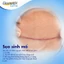Gel Mờ Sẹo Dermatix Ultra 15g - Dematix Gel Làm Phẳng Mềm Mờ Sẹo Thâm Sau Sinh An Toàn Cho Mẹ Và Bé