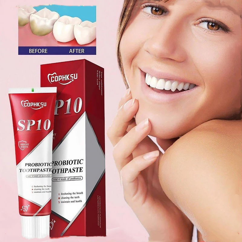 Kem Đánh Răng - Làm Trắng Răng loại bỏ cao răng hôi miệng tẩy ố vàng -  Kem đánh răng Probiotic SP-10 100g
