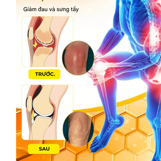 Cao Xoa Bóp Xương Khớp Dân Tộc Miêu MIAOJIANG-Cao Massage MIAOJIANG HONGKONG Giảm Đau Nhức Mỏi Cổ Vai Gáy