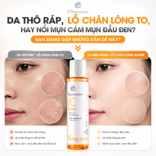 【Xả kho】Nước dưỡng da VC CNMOFAXIN 150ml, giảm mụn đầu đen & mụn ẩn, cải thiện lỗ chân lông to xù xì【26.11】