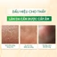 Toner Đậu Đỏ Cỏ Cây Hoa Lá 30g – Cấp Ẩm, Giúp Da Căng Bóng, Chống Lão Hóa