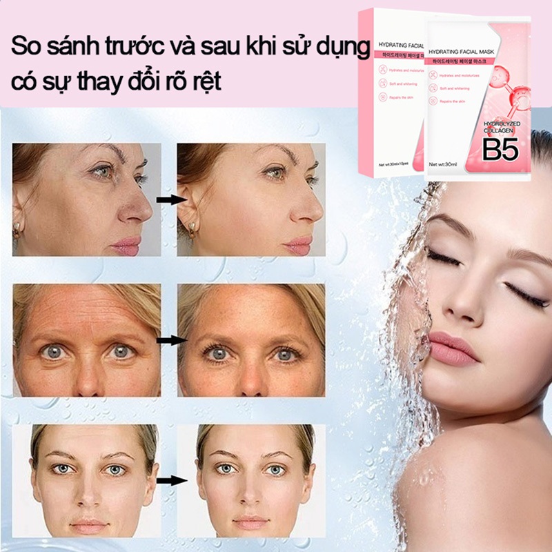 Hộp 10 Miếng Mặt Nạ B5 YUEJIIN - Dưỡng Ẩm Sâu Làm Dịu Da Hỗ Trợ Làm Sáng Da Cấp Nước Phục Hồi Da Khô Nhạy Cảm