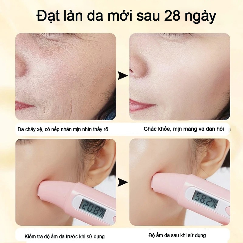 Hộp 10 Miếng Mặt Nạ B5 YUEJIIN - Dưỡng Ẩm Sâu Làm Dịu Da Hỗ Trợ Làm Sáng Da Cấp Nước Phục Hồi Da Khô Nhạy Cảm